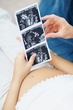 grávida com imagens de ecografia